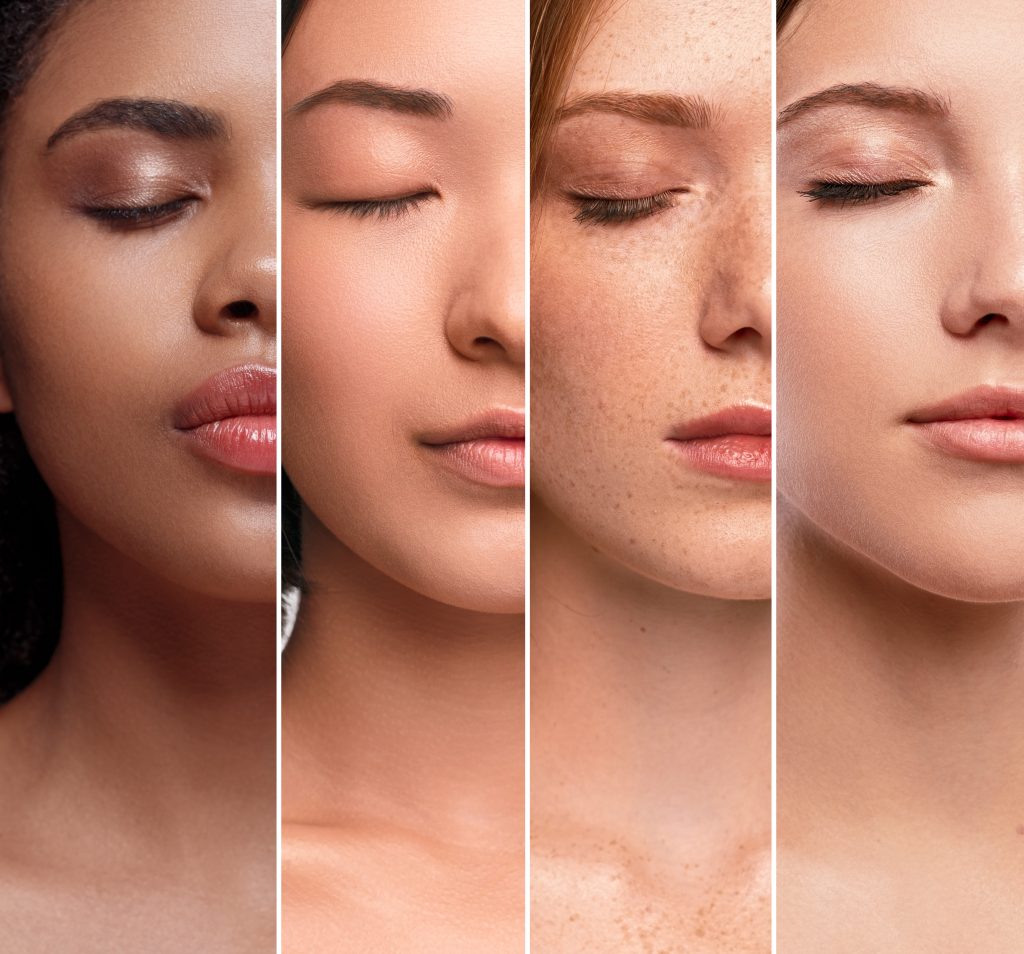 skin types